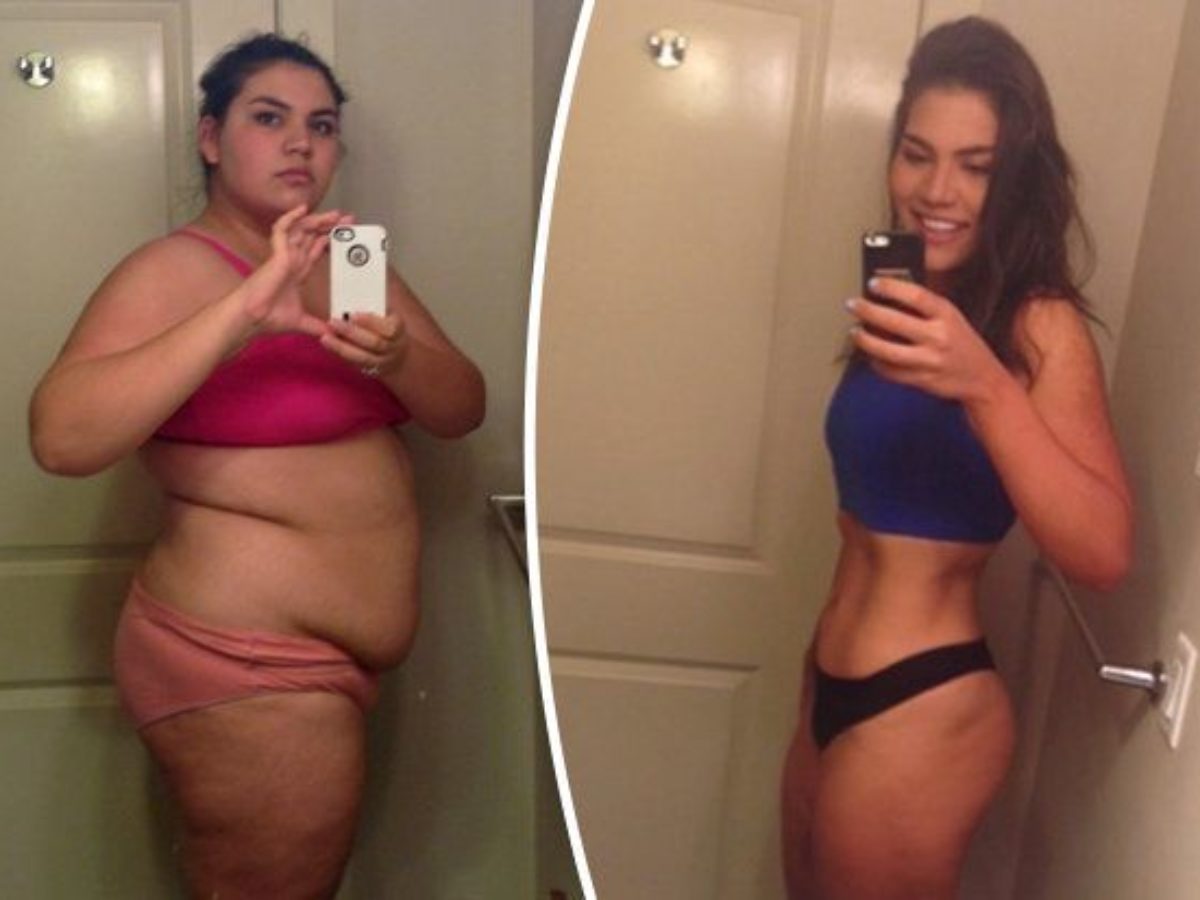 Живот девушки до и после похудения